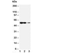 Western blot testing of RAGE antibody and Lane 1: recombinant human protein 10ng; 2: 5ng; 3: 2.5ng