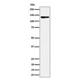 Western blot testing of human HeLa cell lysate with MCM2 antibody. Commonly observed at 100-130 kDa.