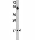 Western blot analysis of UBE2V1 antibody and mouse cerebellum tissue lysate.