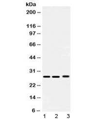 Western blot testing of 1) rat testis, 2) mouse lung and 3) human 293T lysate with PSMA3 antibody at 0.5ug/ml. Predicted/observed molecular weight ~28 kDa.