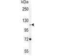 Western blot testing of human NCI-H460 cell lysate with Protocadherin alpha-C2 antibody. Predicted molecular weight ~109 kDa.
