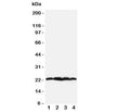 Western blot testing of BAG2 antibody; Lane 1: rat testis; 2: HeLa; 3: A549; 4: A431 cell lysate. Predicted/observed molecular weight: ~22kDa.