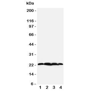 Western blot testing of BAG2 antibody; Lane 1: rat testis; 2: HeLa; 3: A549; 4: A431 cell lysate. Predicted/observed molecular weight: ~22kDa.