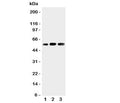 Western blot testing of KIN17 antibody and Lane 1: rat skeletal muscle; 2: human placenta; 3: rat testis tissue lysate. Predicted molecular weight ~45kDa.