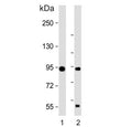 Western blot testing of 1) mouse cerebellum and 2) rat cerebellum tissue lysate with TRPV1 antibody. Predicted molecular weight ~95 kDa.