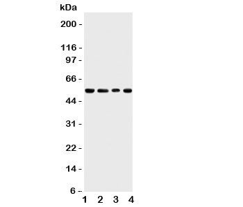Western blot testing of TRAF4 antbody; Lane 1: rat thymus; 2: human HeLa; 3: (h) Jurkat; 4: mouse HEPA cell lysate. Predicted molecular weight: ~54 kDa.