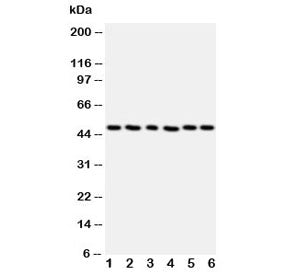 Western blot testing of HDAC3 antibody and Lane 1: rat stomach; 2: rat testis; 3: MCF-7; 4: HeLa; 5: Jurkat; 6: SKOV cell lysate. Predicted molecular weight ~49 kDa.