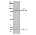 Western blot testing of human HL60 cell lysate with MPO antibody. Expected molecular weight: 59-64 kDa (alpha chain, may be observed at higher molecular weights due to glycosylation), 150+ kDa (glycosylated mature form).