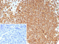 IHC staining of FFPE human tonsil tissue with recombinant CD20 antibody (clone MS4A1/8072R). Inset: PBS used in place of primary Ab (secondary Ab negative control). HIER: boil tissue sections in pH 9 10mM Tris with 1mM EDTA for 20 min and allow to cool before testing.