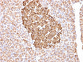 IHC staining of FFPE human pancreas with FTH1 antibody (clone FTH/2081). HIER: boil tissue sections in pH 9 10mM Tris with 1mM EDTA for 10-20 min and allow to cool before testing.