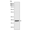 Western blot testing of mouse skeletal muscle lysate with Hsp20 antibody. Predicted molecular weight: 17-20 kDa.