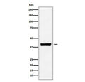 Western blot testing of human A549 cell lysate with ALDOA antibody. Predicted molecular weight ~40 kDa.