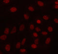 Immunofluorescent staining of MAMDC4 using anti-MAMDC4 antibody (red). MAMDC4 was detected in an immunocytochemical section of cells. Enzyme antigen retrieval was performed using IHC enzyme antigen retrieval reagent for 15 mins. The cells were blocked with 10% goat serum. And then incubated with 5 ug/ml rabbit anti-MAMDC4 antibody overnight at 4oC. Cy3 Conjugated Goat Anti-Rabbit IgG was used as secondary antibody at 1:500 dilution and incubated for 30 min at 37oC.