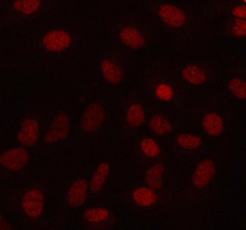 Immunofluorescent staining of MAMDC4 using anti-MAMDC4 antibody (red). MAMDC4 was detected in an immunocytochemical section of cells. Enzyme antigen retrieval was performed using IHC enzyme antigen retrieval reagent for 15 mins. The cells were blocked with 10% goat serum. And then incubated with 5 ug/ml rabbit anti-MAMDC4 antibody overnight at 4oC. Cy3 Conjugated Goat Anti-Rabbit IgG was used as secondary antibody at 1:500 dilution and incubated for 30 min at 37oC.