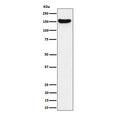 Western blot testing of human Jurkat cell lysate with VGL antibody. Predicted molecular weight ~141 kDa.