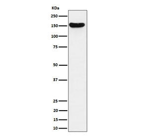 Western blot testing of human Jurkat cell lysate with VGL antibody. Predicted molecular weight ~141 kDa.