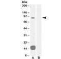 Western blot testing of human heart lysate with GRAF antibody at 0.3ug/ml with [B] and without [A] blocking/immunizing peptide. Predicted molecular weight: ~92 kDa.