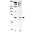 Western blot testing of 1) mouse brain and 2) rat RH35 lysate with FGF7 antibody at 0.5ug/ml. Predicted molecular weight ~22 kDa.