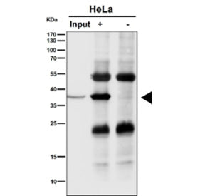 Immunoprecipitation analysis using the NMI antibody at 1:50 dilution (Western blot at 1:1000 dilution). Predicted molecular weight ~35 kDa.