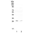 Western blot testing of 1) human SW620 and 2) human HepG2 cell lysate with RNF186 antibody at 0.5ug/ml. Predicted molecular weight ~24 kDa.