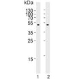 Western blot testing of human kidney tissue lysate with CPM antibody. Expected molecular weight: 51-65 kDa depending on glycosylation level.