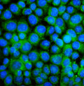 Immunofluorescent staining of FFPE human MCF7 cells with BAK antibody (green) and DAPI nuclear stain (blue). HIER: steam section in pH6 citrate buffer for 20 min.