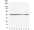 Western blot testing of beta-Actin antibody and rat tissue: ovary (1), testis (2), heart (3), brain (4); and human cell lines, lanes 5: A453; 6: HeLa; 7: SMMC-7721; 8: HT1080; 9: SW620 cell lysate