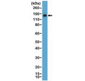 Western blot testing of human HEK293 cell lysate with recombinant MSH6 antibody at 1:1000 dilution. Expected molecular weight: 120-160 kDa depending on phosphorylation level.