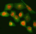 Immunofluorescent staining of NUP88 using anti-NUP88 antibody (red) and anti-Beta Tubulin antibody (green). NUP88 was detected in immunocytochemical section of human HELA cell. Enzyme antigen retrieval was performed using IHC enzyme antigen retrieval reagent for 15 mins. The cells were blocked with 10% goat serum. And then incubated with 5 ug/ml rabbit anti-NUP88 antibody and mouse anti-Beta Tubulin antibody overnight at 4oC.