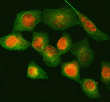 Immunofluorescent staining of NUP88 using anti-NUP88 antibody (red) and anti-Beta Tubulin antibody (green). NUP88 was detected in immunocytochemical section of human HELA cell. Enzyme antigen retrieval was performed using IHC enzyme antigen retrieval reagent for 15 mins. The cells were blocked with 10% goat serum. And then incubated with 5 ug/ml rabbit anti-NUP88 antibody and mouse anti-Beta Tubulin antibody overnight at 4oC.
