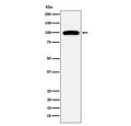 Western blot testing of human Ramos cell lysate with CD10 antibody. Routinely visualized at ~100 kDa.