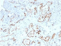 IHC staining of FFPE human cervix tissue with CD31 antibody (clone PECAM1/4341). HIER: boil tissue sections in pH 9 10mM Tris with 1mM EDTA for 20 min and allow to cool before testing.