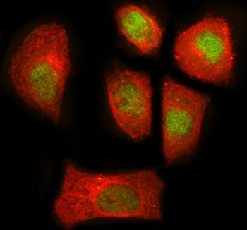 Immunofluorescent staining of NEK7 using anti-NEK7 antibody (green) and anti-Beta Tubulin antibody (red). NEK7 was detected in an immunocytochemical section of SiHa cells. Enzyme antigen retrieval was performed using IHC enzyme antigen retrieval reagent for 15 mins. The cells were blocked with 10% goat serum. And then incubated with 5 ug/ml rabbit anti-NEK7 antibody and mouse anti-Beta Tubulin antibody overnight at 4oC.