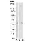 Western blot of HEK293 transfected with human CRISP2-MYC tested with CRISP2 antibody (0.1ug/ml) in Lane A and anti-MYC (1/1000) in lane C. Mock-transfected HEK293 probed with CRISP2 (1ug/ml) in Lane B. Predicted molecular weight: ~27/31kDa (isoforms 1/2).