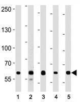 FOXP1 antibody western blot analysis in (1) A549, (2) Daudi, (3) Jurkat, (4) MCF-7, and (5) NCI-H292 lysate