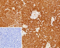 IHC staining of FFPE human pancreas tissue with Colipase antibody (clone CLPS/9900). Inset: PBS used in place of primary Ab (secondary Ab negative control). HIER: boil tissue sections in pH 9 10mM Tris with 1mM EDTA for 20 min and allow to cool before testing.