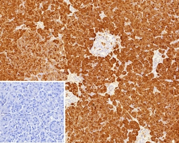 IHC staining of FFPE human pancreas tissue with Colipase antibody (clone CLPS/9900). Inset: PBS used in place of primary Ab (secondary Ab negative control). HIER: boil tissue sections in pH 9 10mM Tris with 1mM EDTA for 20 min and allow to cool before testing.