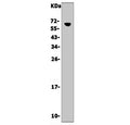 Western blot testing of mouse thymus lysate with Cd16 antibody. Expected molecular weight: 30-70 kDa depending on the level of glycosylation.