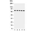 Western blot testing of ABCG2 antibody and Lane 1: HeLa; 2: SW620; 3: MCF-7; 4: SKOV; 5: Jurkat cell lysate. Predicted molecular weight ~72kDa.