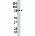 Anti-HA tag antibody testing a tagged recombinant protein.