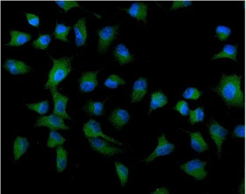 Immunofluorescent staining of FFPE human A549 cells with ATG9A antibody (green) and DAPI nuclear stain (blue). HIER: steam section in pH6 citrate buffer for 20 min.