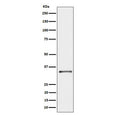 Western blot testing of human A431 cell lysate with Cytochrome b5 reductase 3 antibody. Predicted molecular weight ~34 kDa.