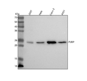 Western blot analysis of PUDP using anti-PUDP antibody. Lane 1: human 293T whole cell lysates, Lane 2: human Hela whole cell lysates, Lane 3: human Caco-2 whole cell lysates, Lane 4: human whole cell lysates. After electrophoresis, proteins were transferred to a nitrocellulose membrane at 150 mA for 50-90 min. Blocked the membrane with 5% non-fat milk/TBS for 1.5 hour at RT.