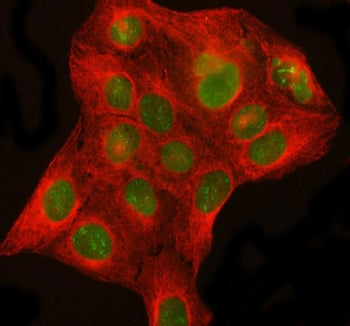 Immunofluorescent staining of FFPE human U-2 OS cells with DHX15 antibody (green) and Beta Tubulin mAb (red). HIER: steam section in pH6 citrate buffer for 20 min.