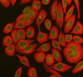Immunofluorescent staining of using anti-MX1 antibody (green) and anti-Tubulin Alpha antibody (red). MX1 was detected in immunocytochemical section of SiHa cell. Enzyme antigen retrieval was performed using IHC enzyme antigen retrieval reagent for 15 mins. The cells were blocked with 10% goat serum. And then incubated with 5 ug/ml rabbit anti-MX1 antibody and mouse anti-Tubulin Alpha antibody overnight at 4oC. DyLight 488 Conjugated Goat Anti-Rabbit IgG and Cy3 Conjugated Goat Anti-Mouse IgG were used as se