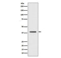 Western blot testing of human HepG2 cell lysate with H2AFY antibody. Predicted molecular weight ~40 kDa.