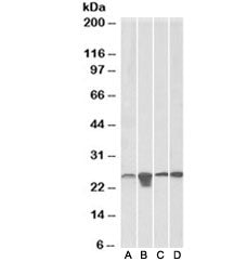 Western blot testing of A) HeLa, B) HepG2, C) HEK293 and D) mouse NIH3T3 lysate with SOD2 antibody at 0.1ug/ml. Predicted molecular weight ~25kDa.