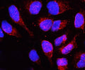 Immunofluorescent staining of human U-2 OS cells with LBR antibody (red) and DAPI nuclear stain (blue). HIER: steam section in pH6 citrate buffer for 20 min.