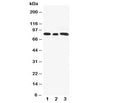 Western blot testing of Gli3 antibody and Lane 1: rat testis; 2: human A549; 3: (h) SW620 cell lysate