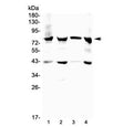 Western blot testing of 17-beta-Hydroxysteroid dehydrogenase 4 antibody and Lane 1: mouse heart; 2: rat heart; 3: human placenta 4: human MCF7 lysate. Predicted molecular weight ~80 kDa.